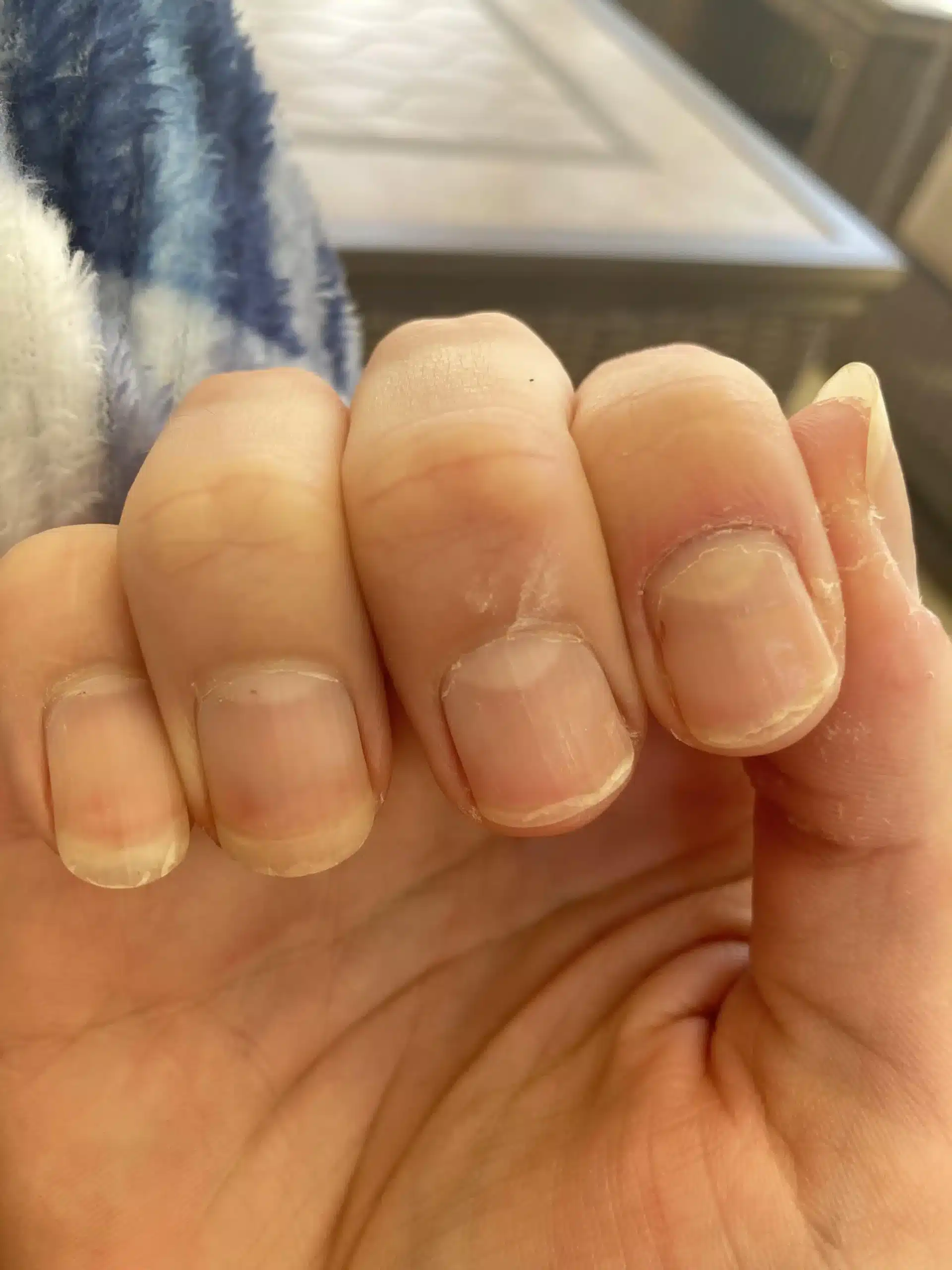 A view of a hand with chipped nails jpg A view of a hand with chipped nails jpg