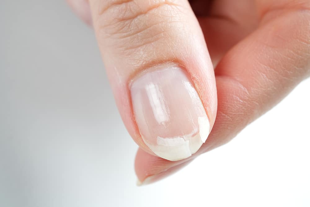 A view of a broken nail